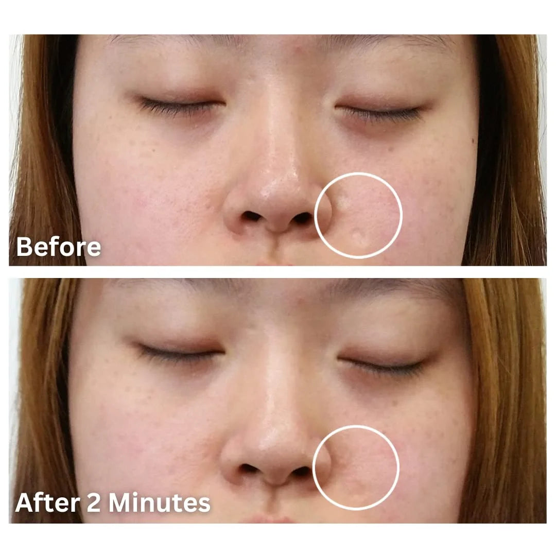 Bronze Medium Waterproof Scar Filler Concealer Refill Applicator U802989